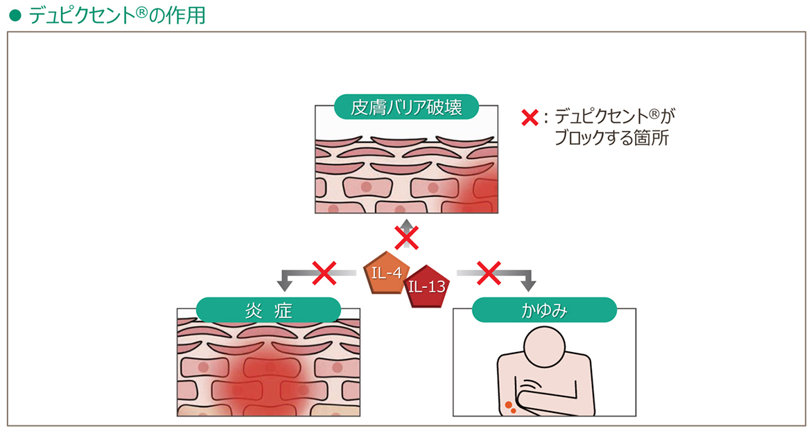 デュピクセント®の作用